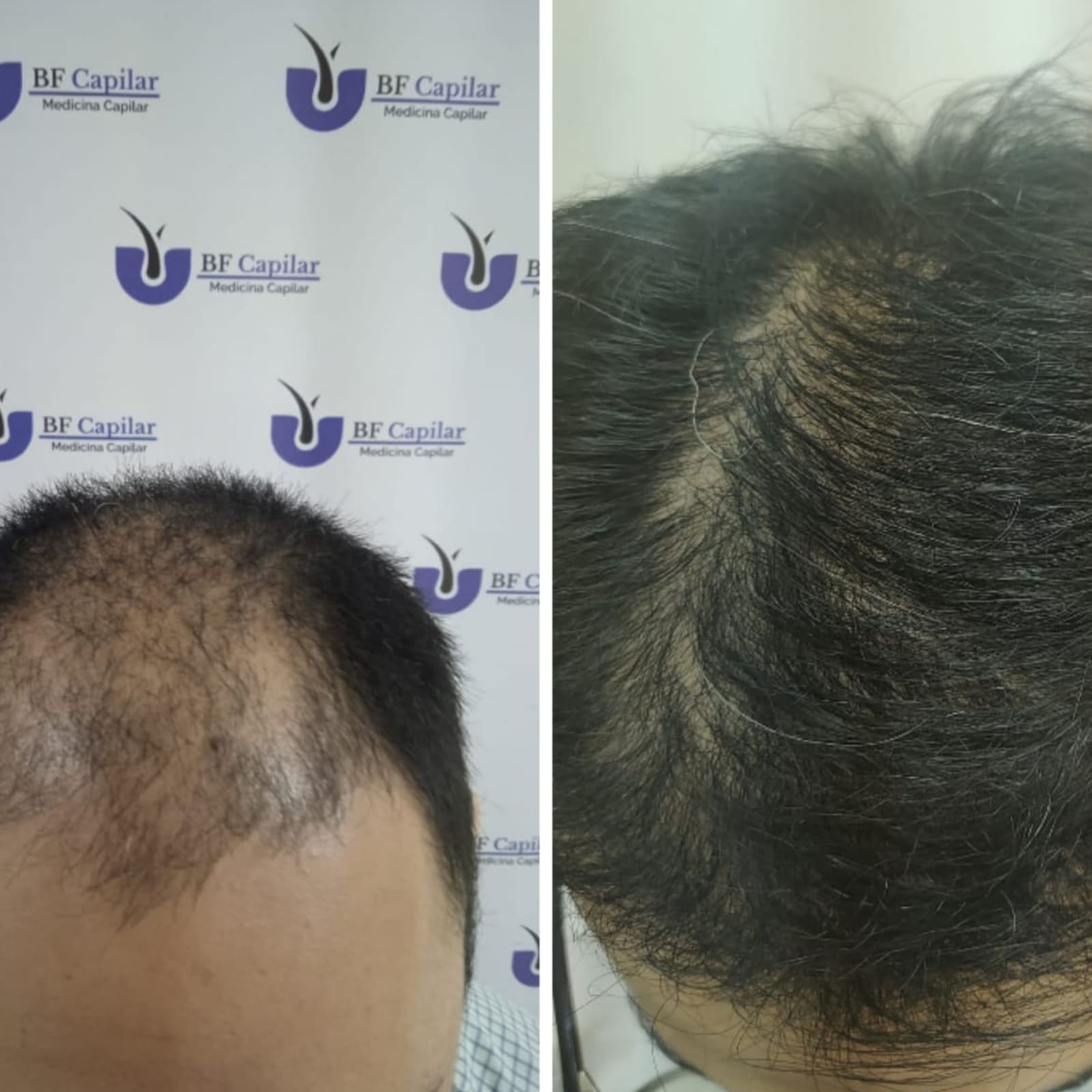 testimonio-de-tratamiendo-para-la-caida-del-cabello